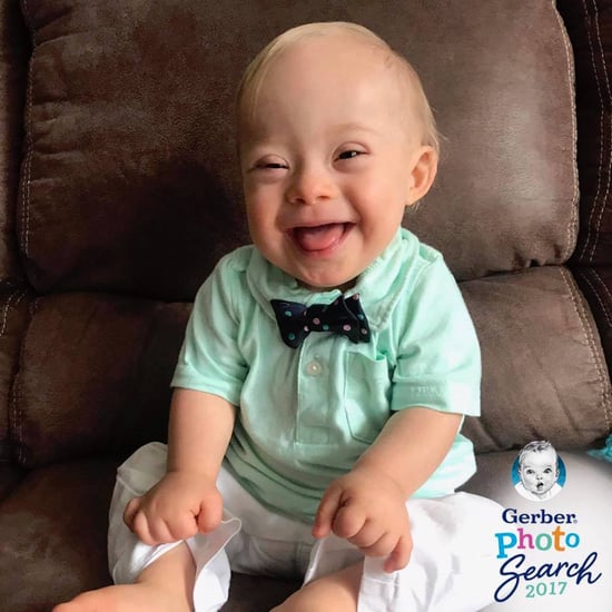 Gerber Baby With Down Syndrome