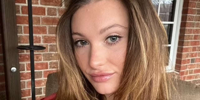 For a Year I Experienced Hair Loss — No One Believed It Was My IUD