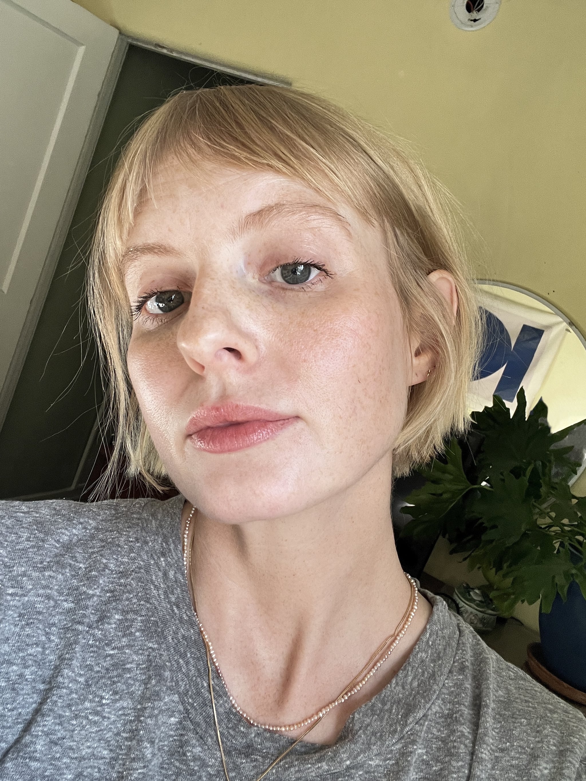 SkinVive after photos