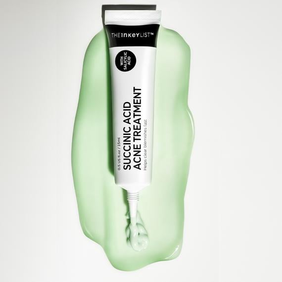 succinic acid acne treatment