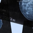 Are AI-Assisted Mammograms the Future? Here's What to Know