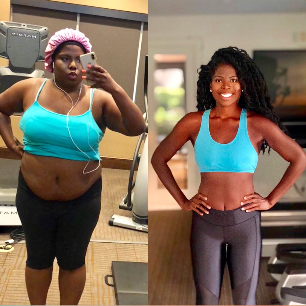 Jasmine Talks About Her Experience With VSG Surgery 140Pound Weight