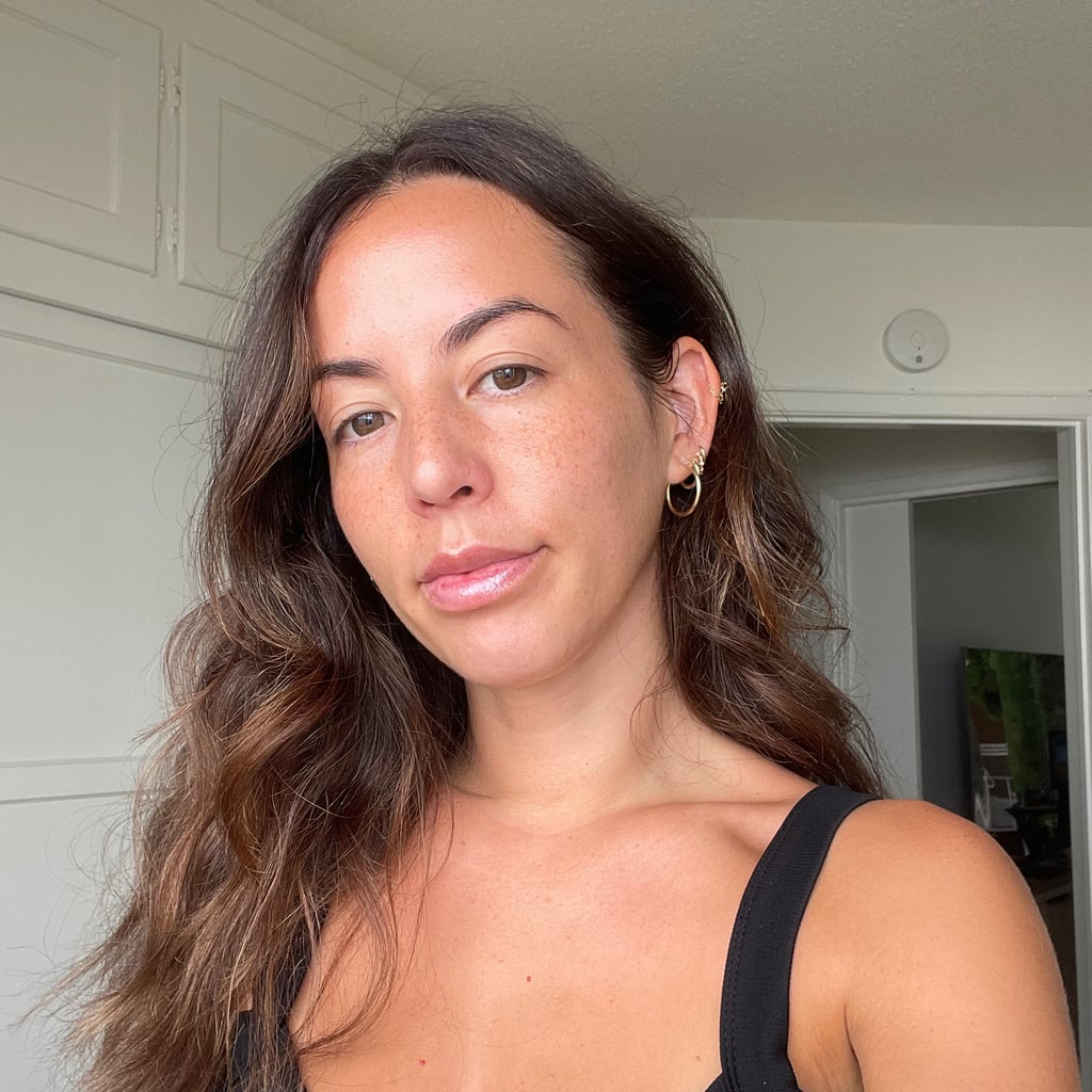 This TikTok-Viral Moisturizer Helped Clear My Acne in Weeks