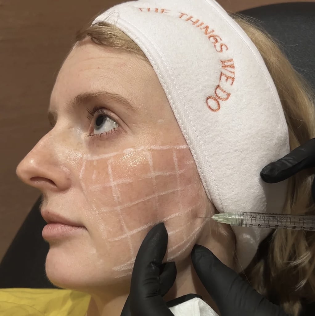 Skinvive "No-Filler" Filler