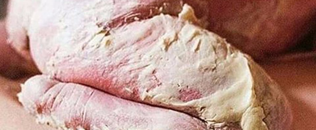 What Is Vernix?