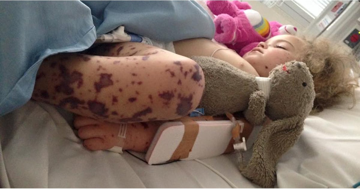 Meningitis B Vaccine For Kids | POPSUGAR Family