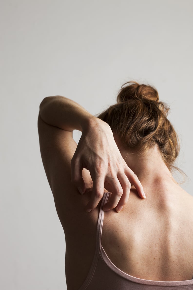  Woman scratching her itchy back.