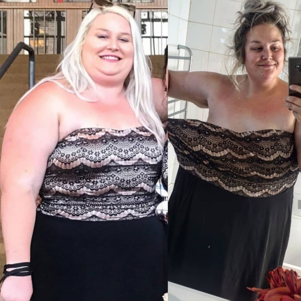 Claire Is Planning to Have Weight-Loss Surgery to Help Her BED