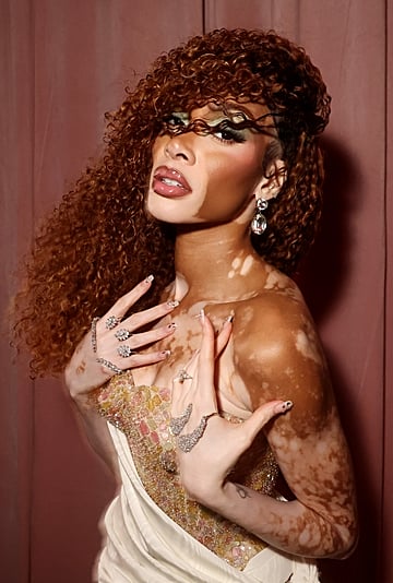 Winnie Harlow's Self-Love and Inner Beauty Advice