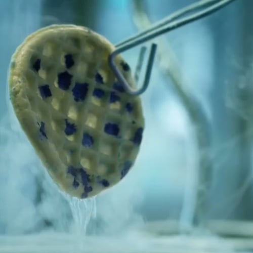 Weight Watchers Super Bowl Commercial