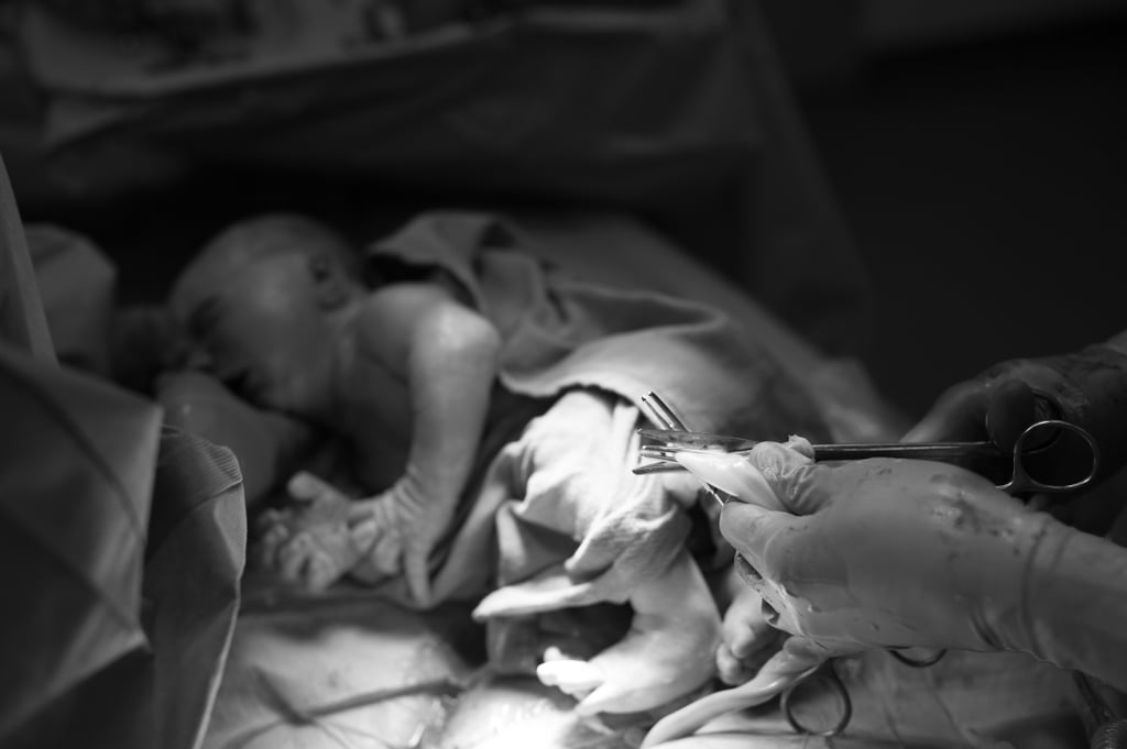 C-Section Birth Story Photo Shoot