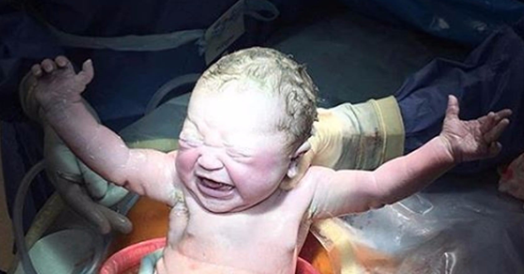 C-Section Birth Photo | PS Family