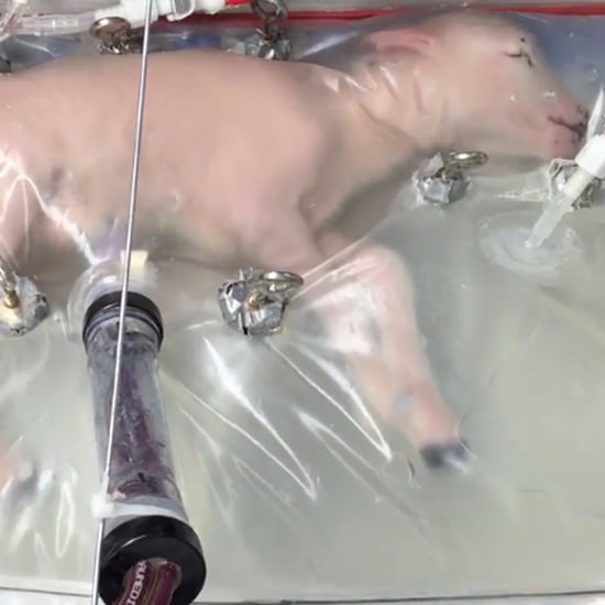 Artificial Womb Premature Babies