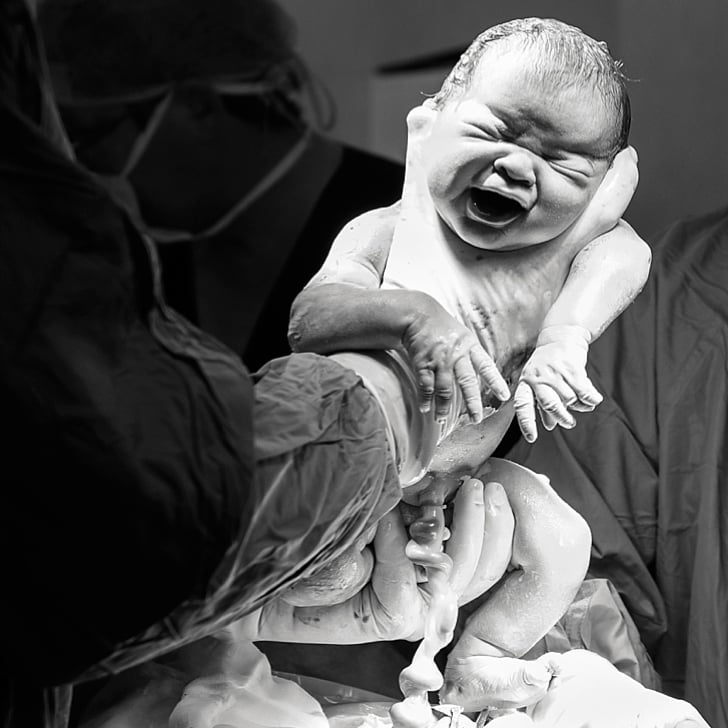 CSection Birth For Blended Family in South Africa POPSUGAR Family