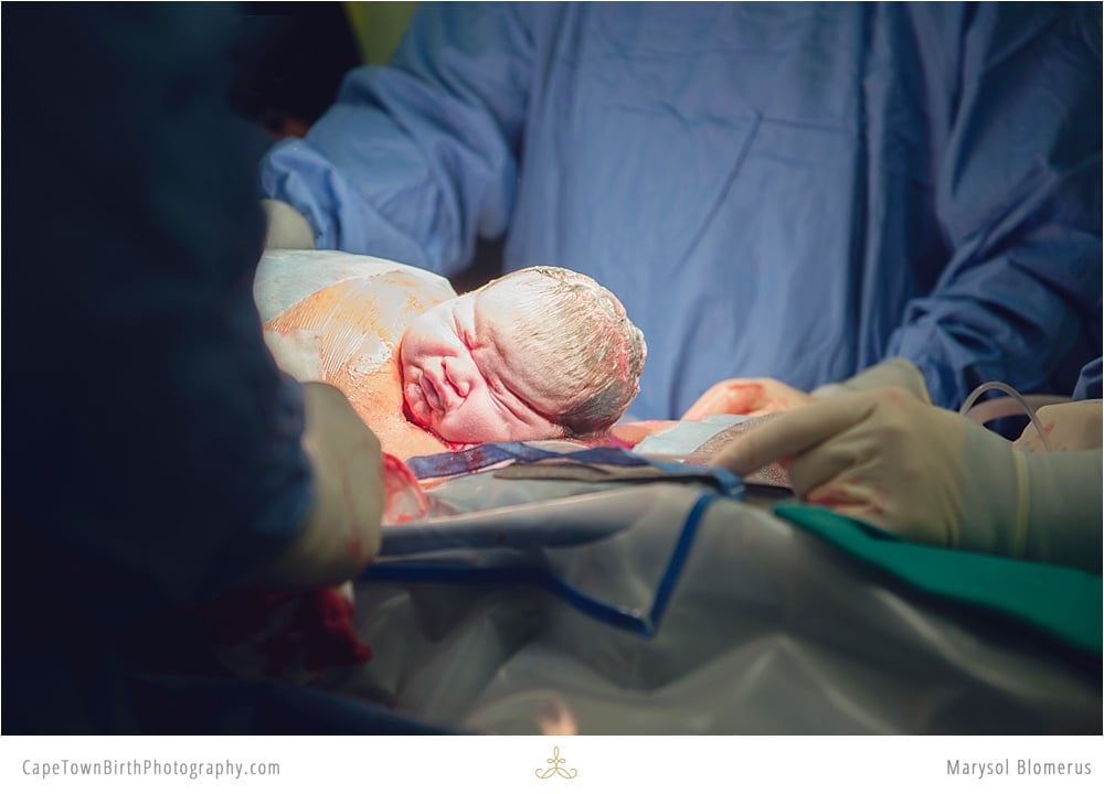 Photos of C-Sections