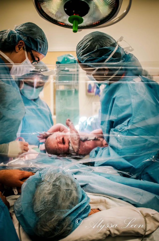 Clear Drapes Family Centered C-Section Birth Photos