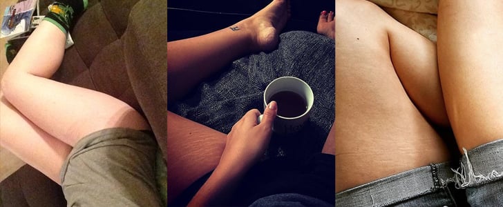 What Is #ThighReading? Photos