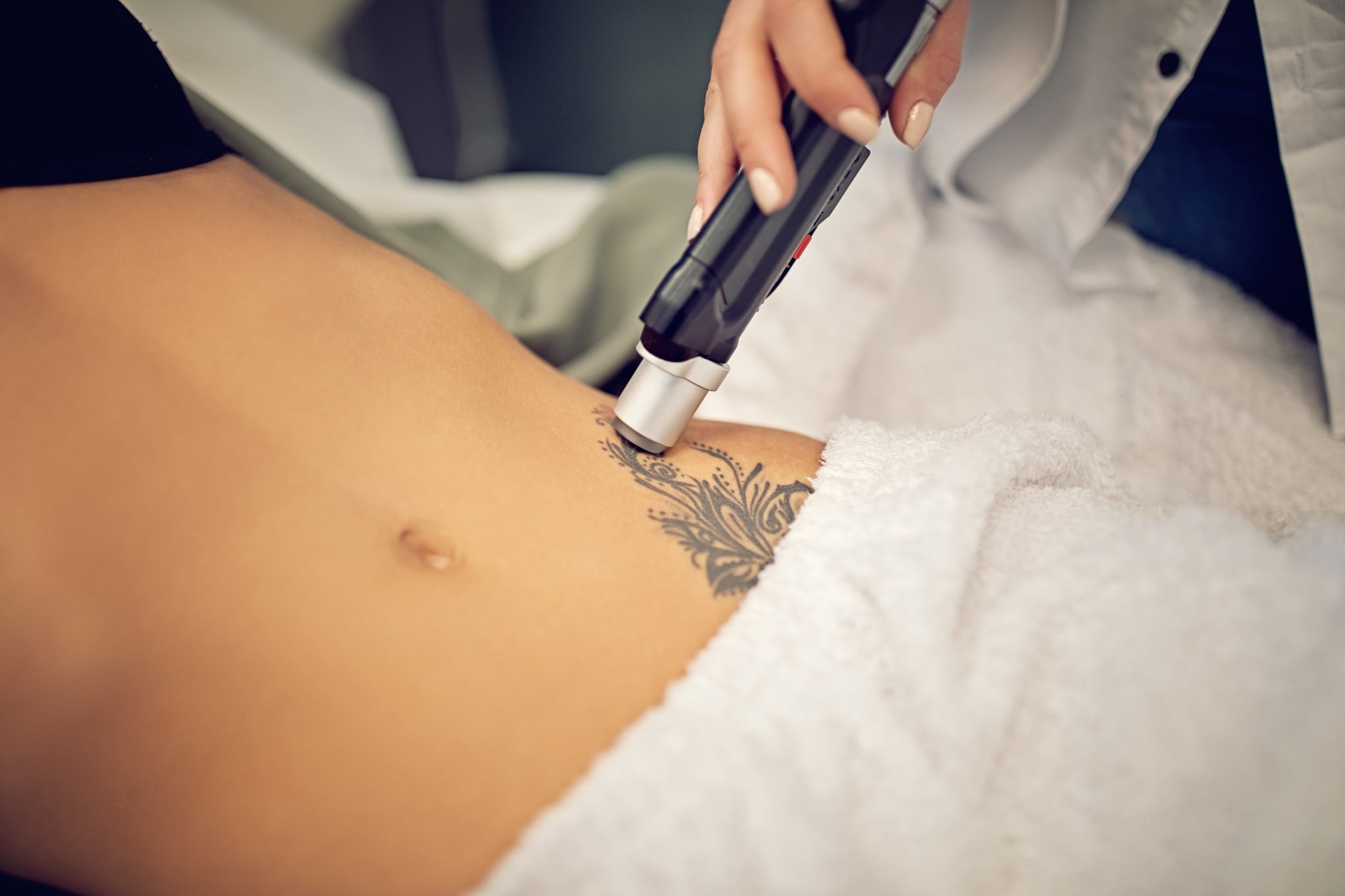 Topical Tattoo Removal Creams: Do They Really Work?