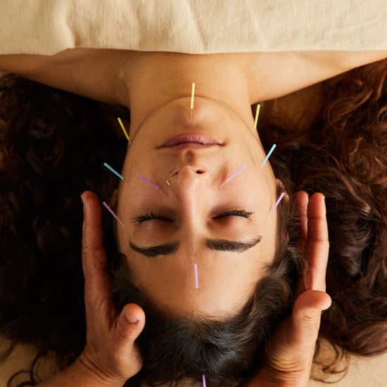 Cosmetic Acupuncture: What It Is, Does It Work, Risks