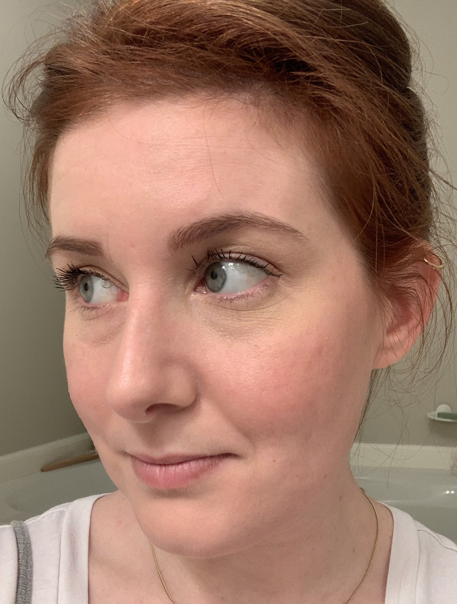 Dermaflash Device Review With Before and After Pictures POPSUGAR Beauty