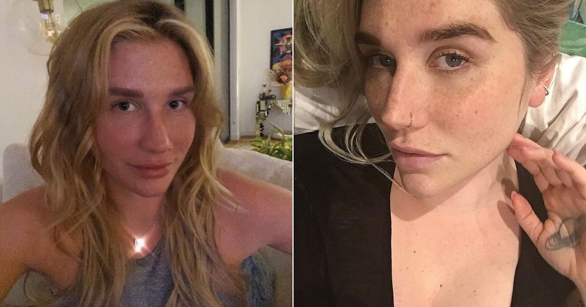 Photos Kesha With No Makeup | POPSUGAR Beauty