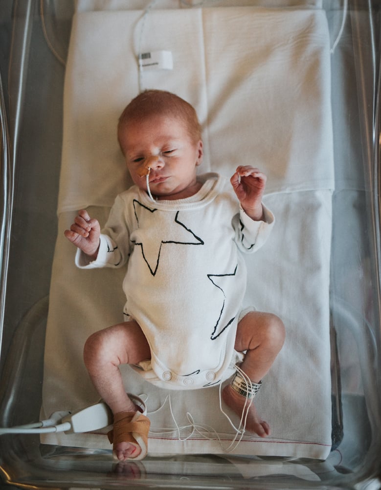 Photos of Premature Baby's Time in the NICU