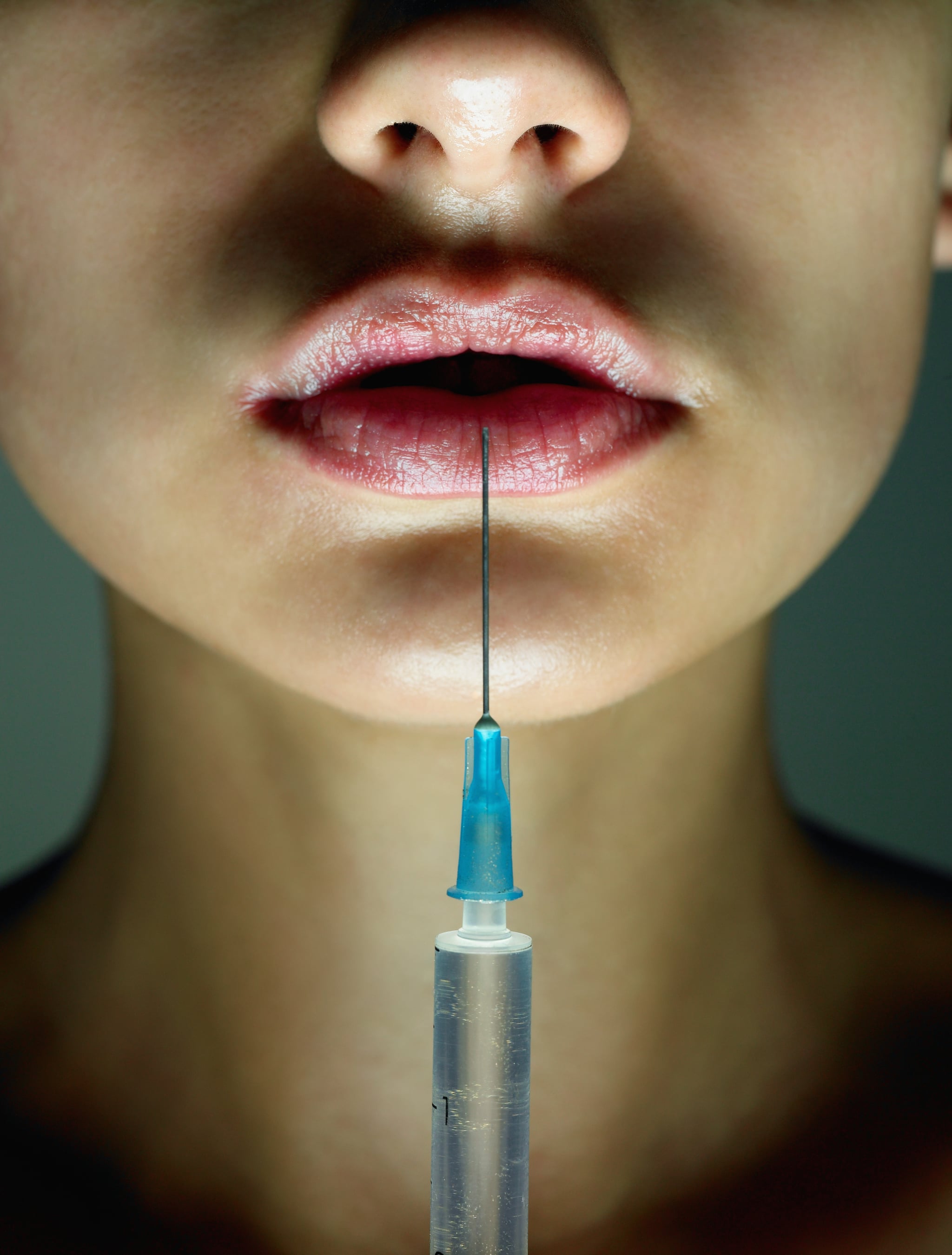 Woman getting lip filler injections.