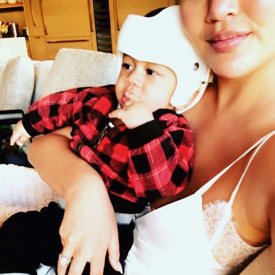 Chrissy Teigen Shares Photo of MIles With Cranial Helmet