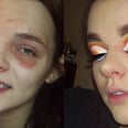 Why This Makeup Artist Is Flaunting Her Eczema on Instagram: "I Am Not My Skin Condition"