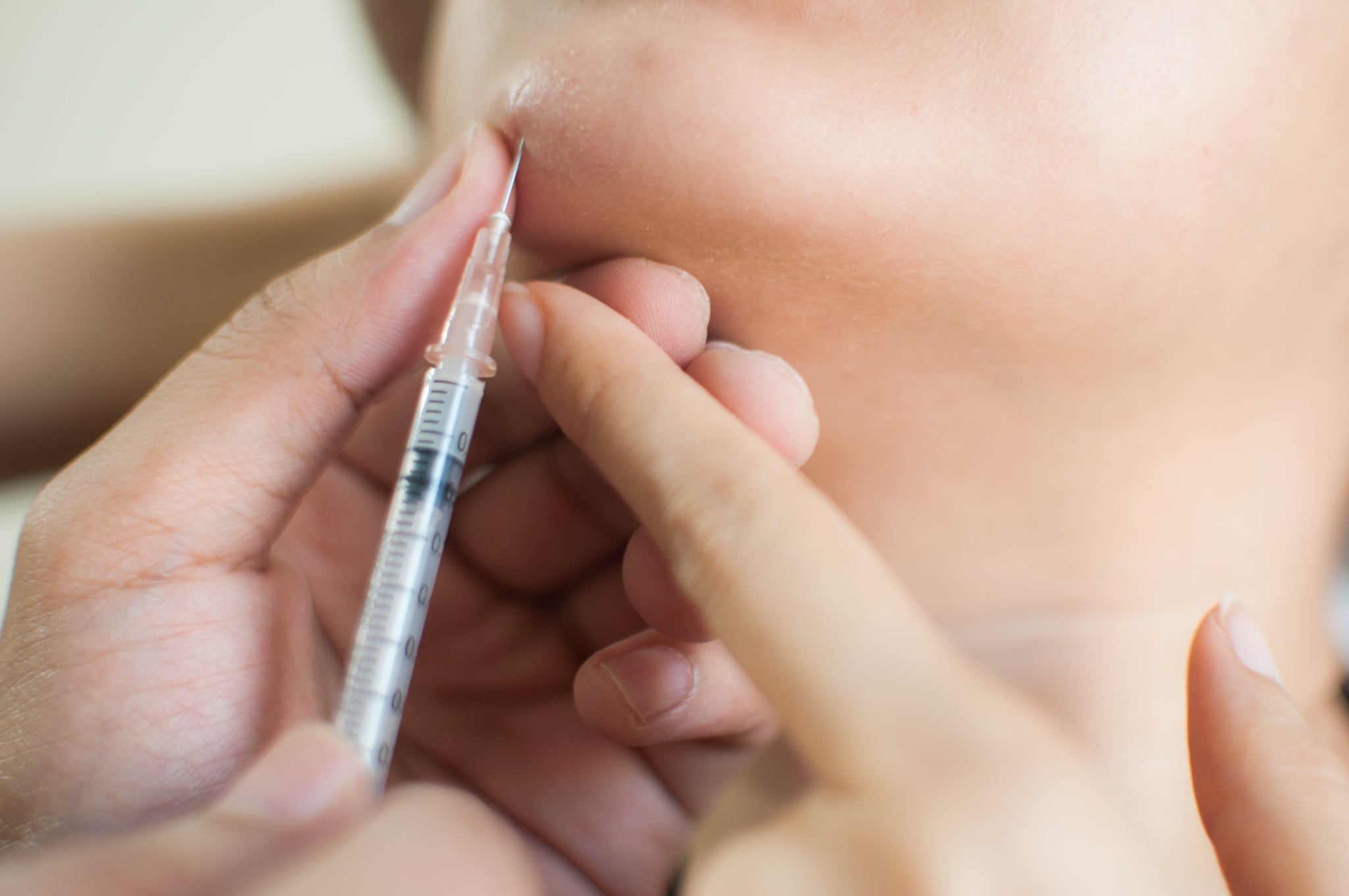 Close-up of hand injecting medicine to a woman's acne