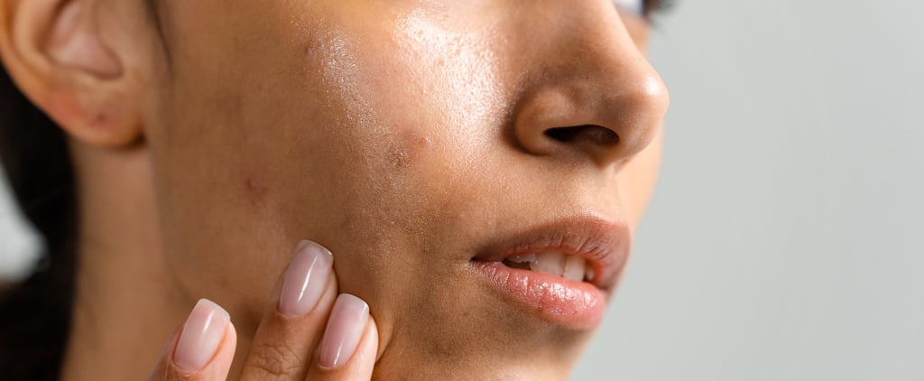 Arbutin For Skin: Benefits, How to Use it, and More