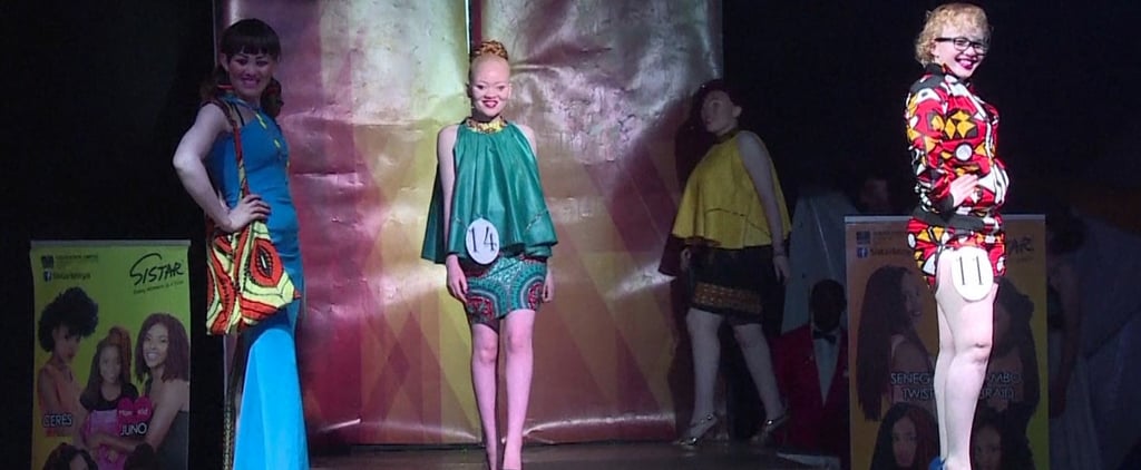 Albinism Beauty Pageant (Video)