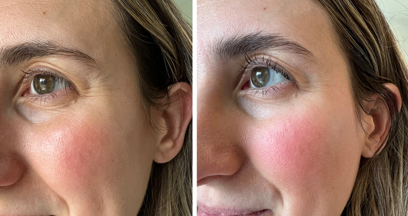 Dr. Naomi Catfish Eye Cream Review With Photos POPSUGAR Beauty