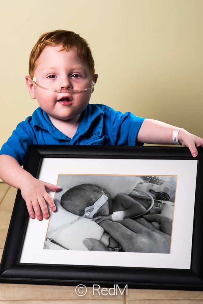 Charles, born at 26 weeks Then and Now Photos of Kids