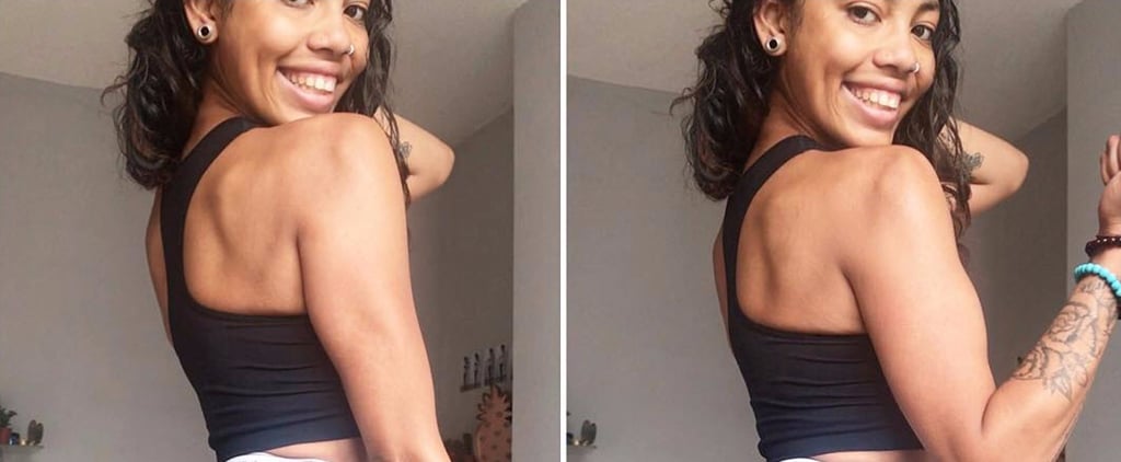 Holly Griffiths Anorexia Transformation Photo