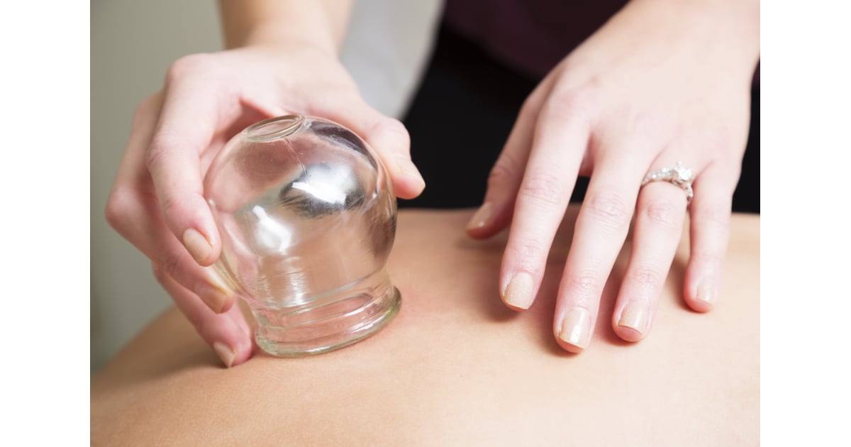 Can Cupping Help Your Lower Back Pain? | POPSUGAR Fitness ...