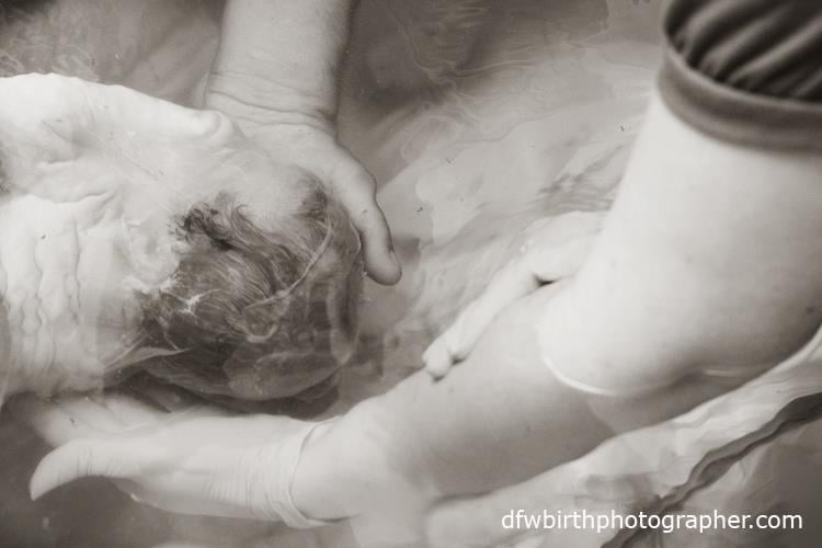 Photos of Babies Born En Caul