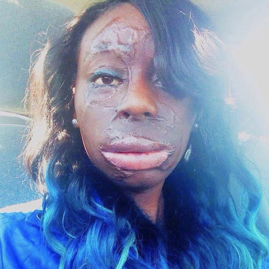 Burn Victim Alyssa McDonald on Flaws Like Diamonds | Video