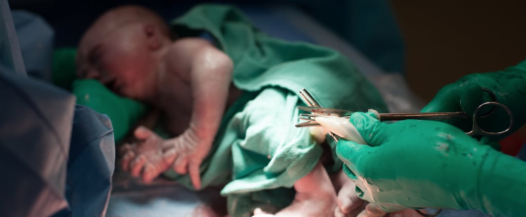 Delayed Umbilical Cord Clamping Could Have Benefits Later On