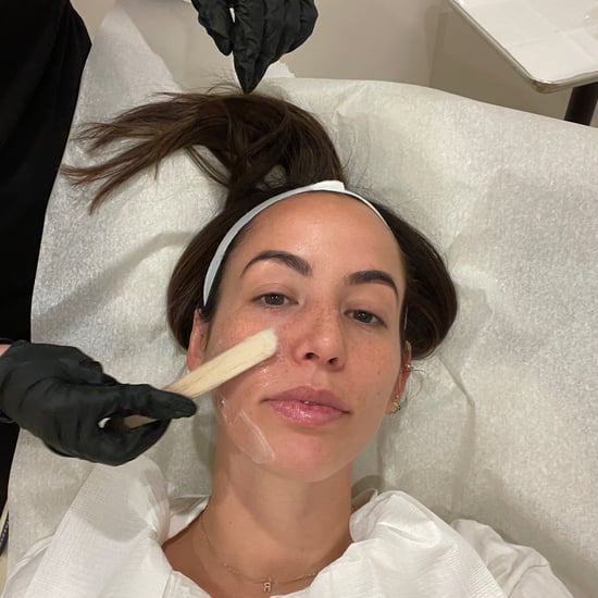 I Tried SkinPen, the Victoria Beckham-Approved Treatment