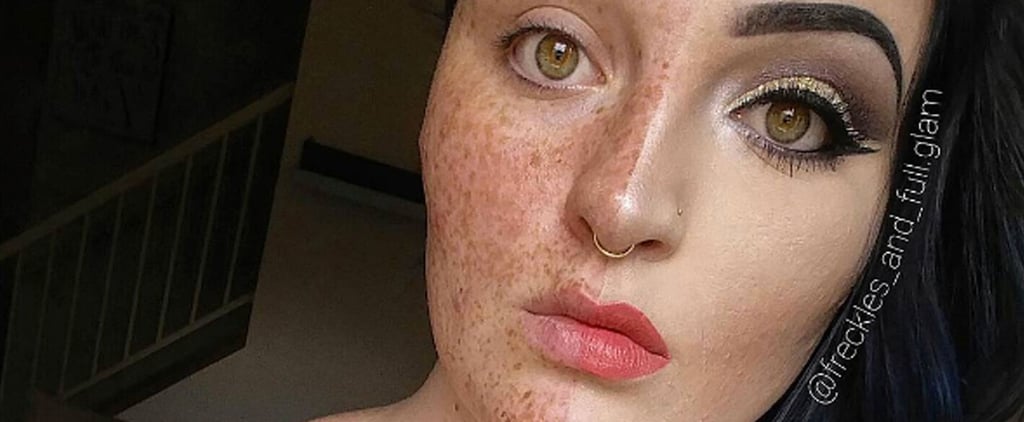 Woman Hides Freckles With Makeup