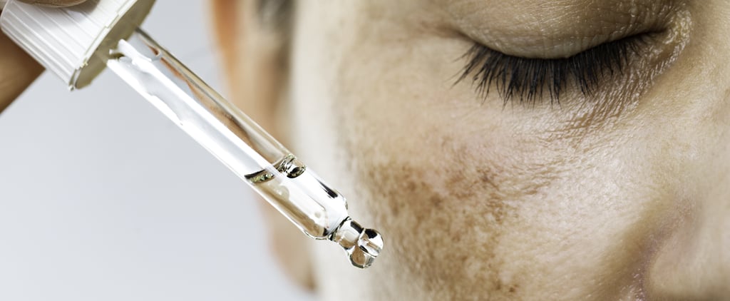 Melasma Treatment and Causes From Doctors
