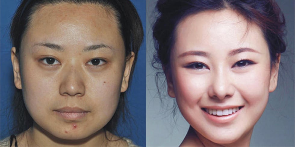 Extreme Plastic Surgery Causes Passport Confusion