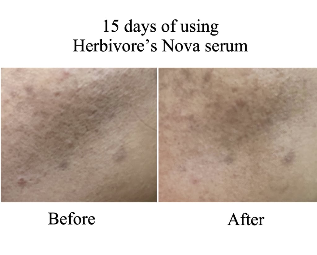 Before and After Using the Herbivore Nova 15% Vitamin C + Turmeric Brightening Serum