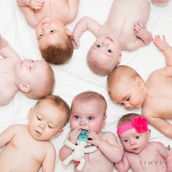 Photo of Babies With Chest Scars From Open-Heart Surgeries