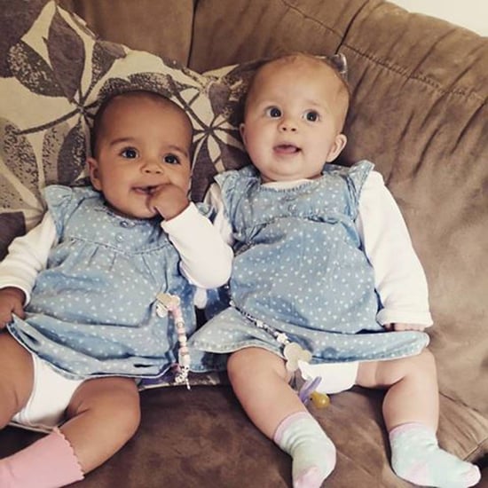 Twin Born With Different Skin Tones