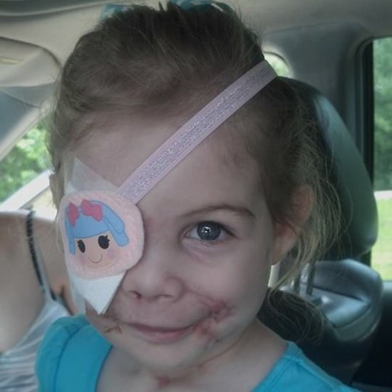 KFC Kicks Out 3-Year-Old For Facial Scars