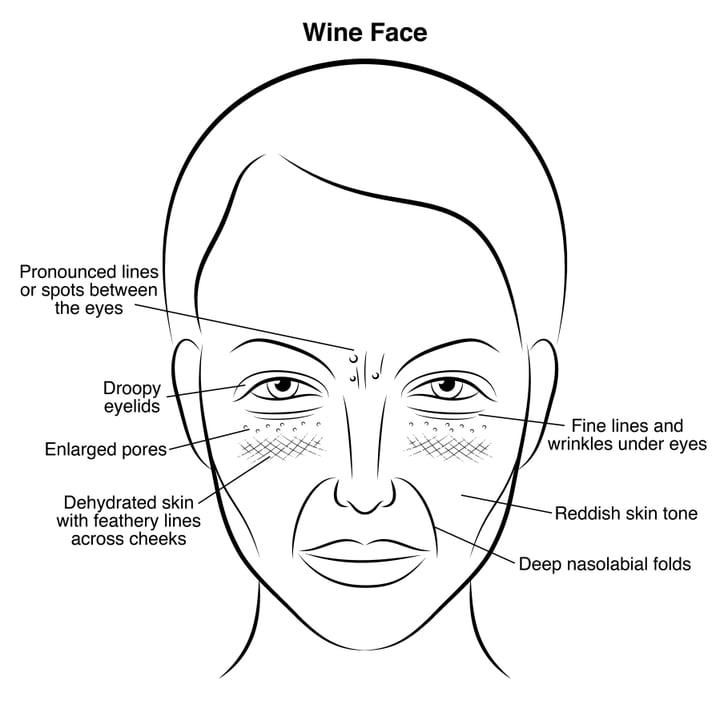 Wine Face Gut Health and Skin Problems POPSUGAR Beauty Photo 5