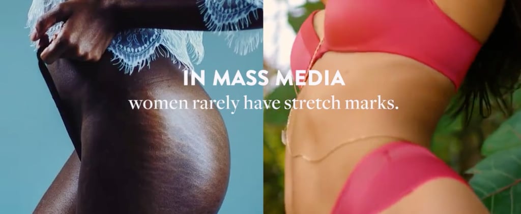 Video About Stretch Marks