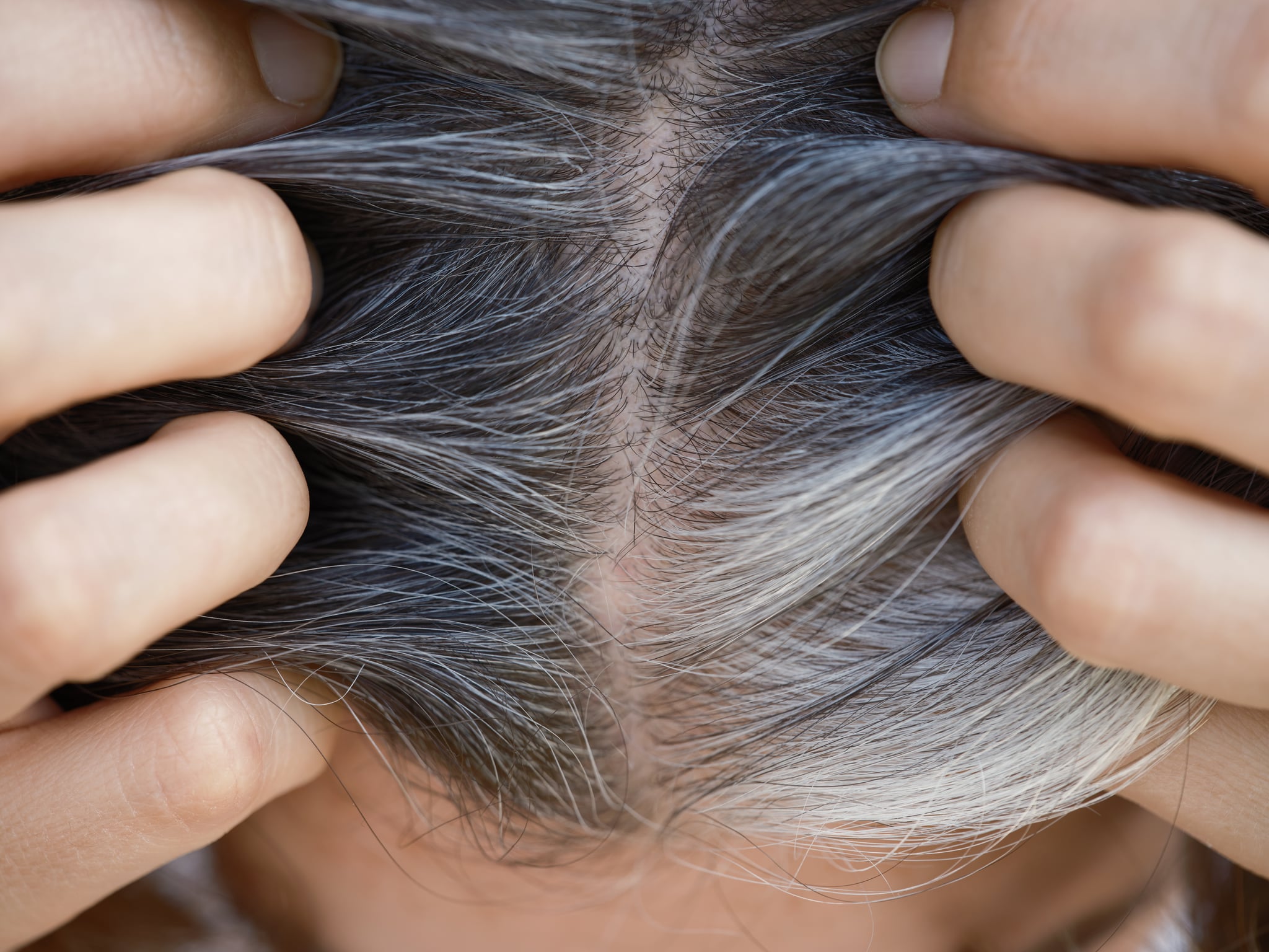 does stress turn hair gray